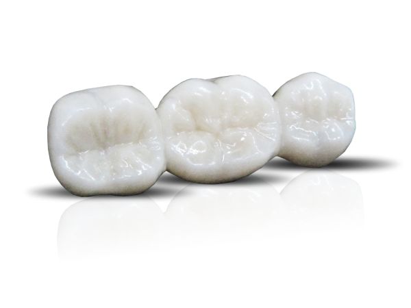 Full-Zirconia-Bridge