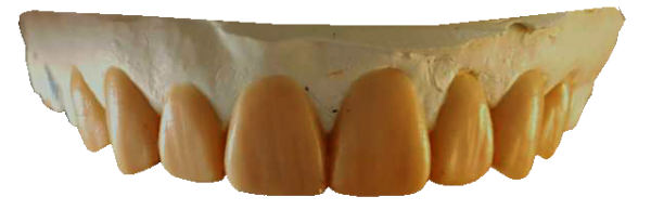 waxup