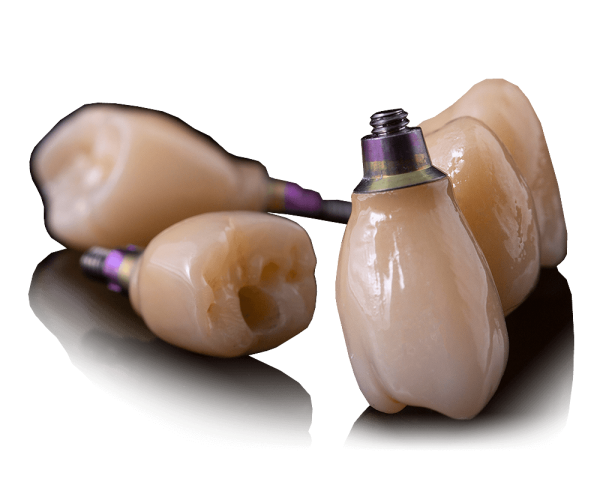 Screw-Retain-Crown-&-Bridge-2