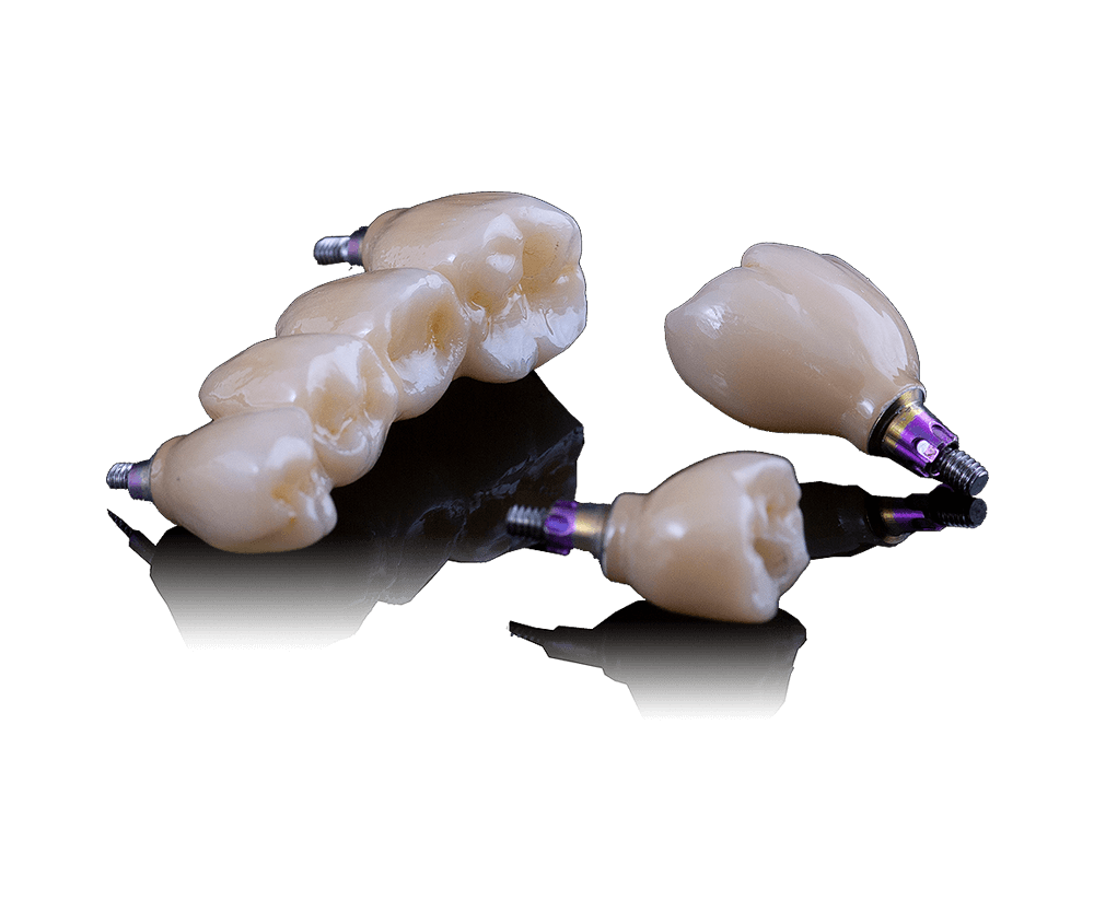 Screw-Retain-Crown-&-Bridge (5)